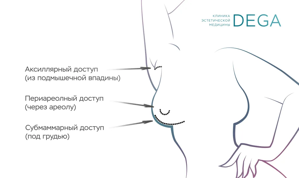 Виды доступов