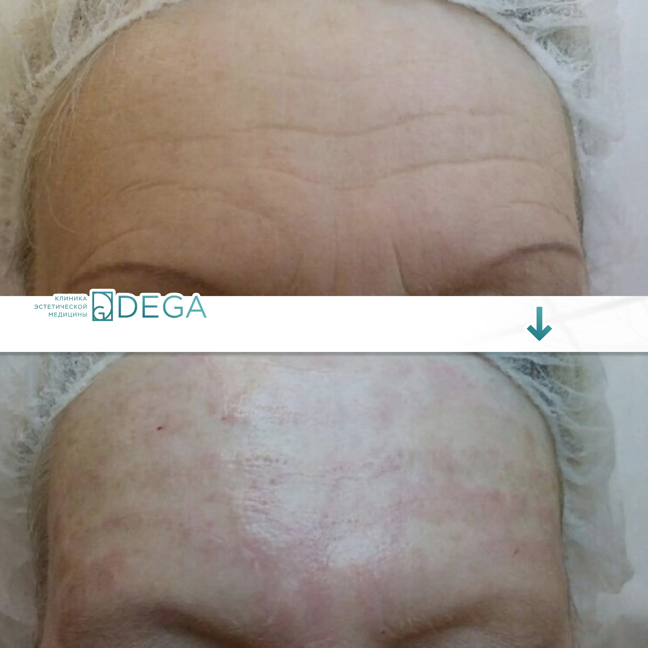 Бабичева С.Ю. —  Контурная пластика №7