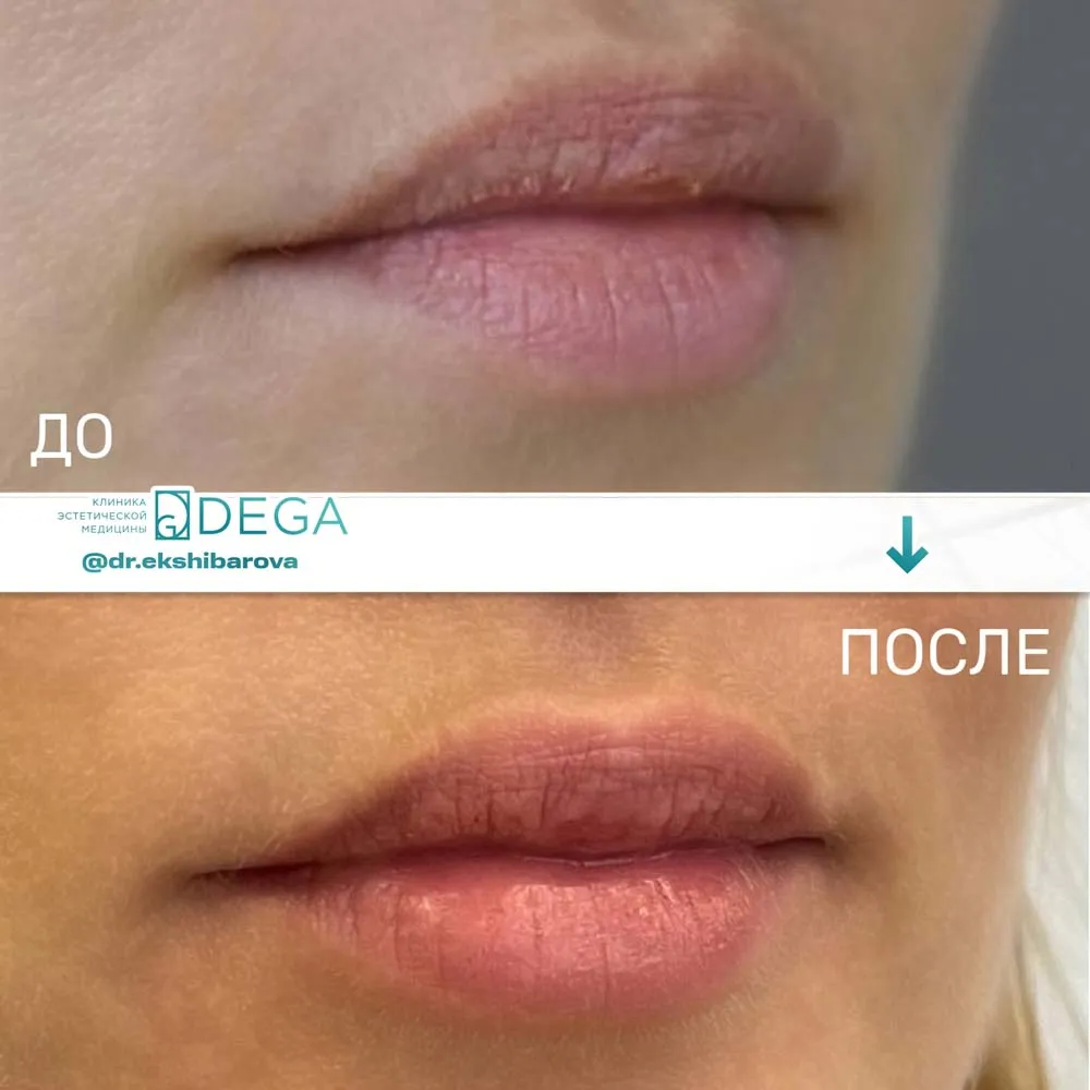 Екшибарова НИ - Контурная пластика №5