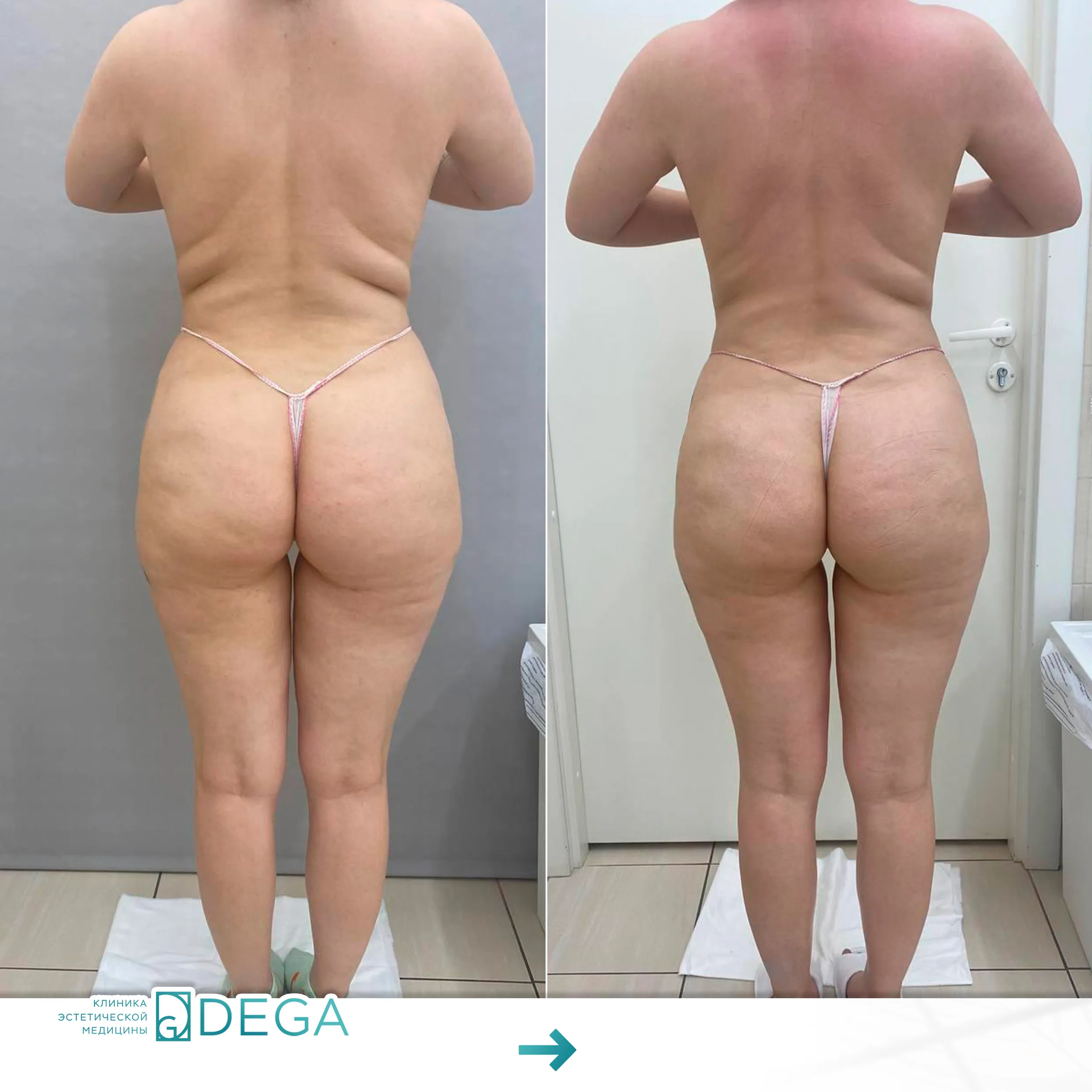 Горновая О.A. - Обертывание №3